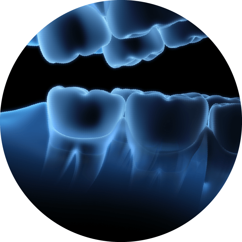 Dental Implant Procedures