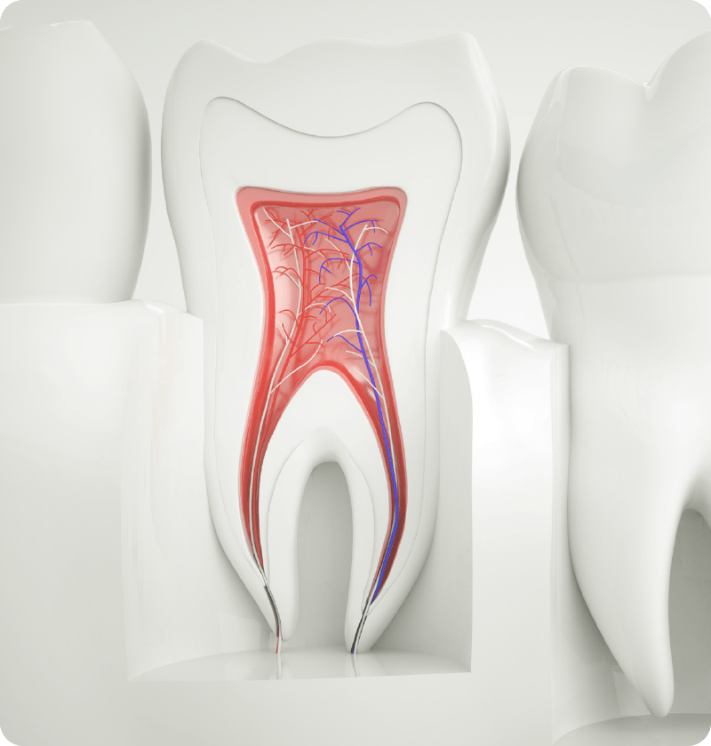 endodontic treatment